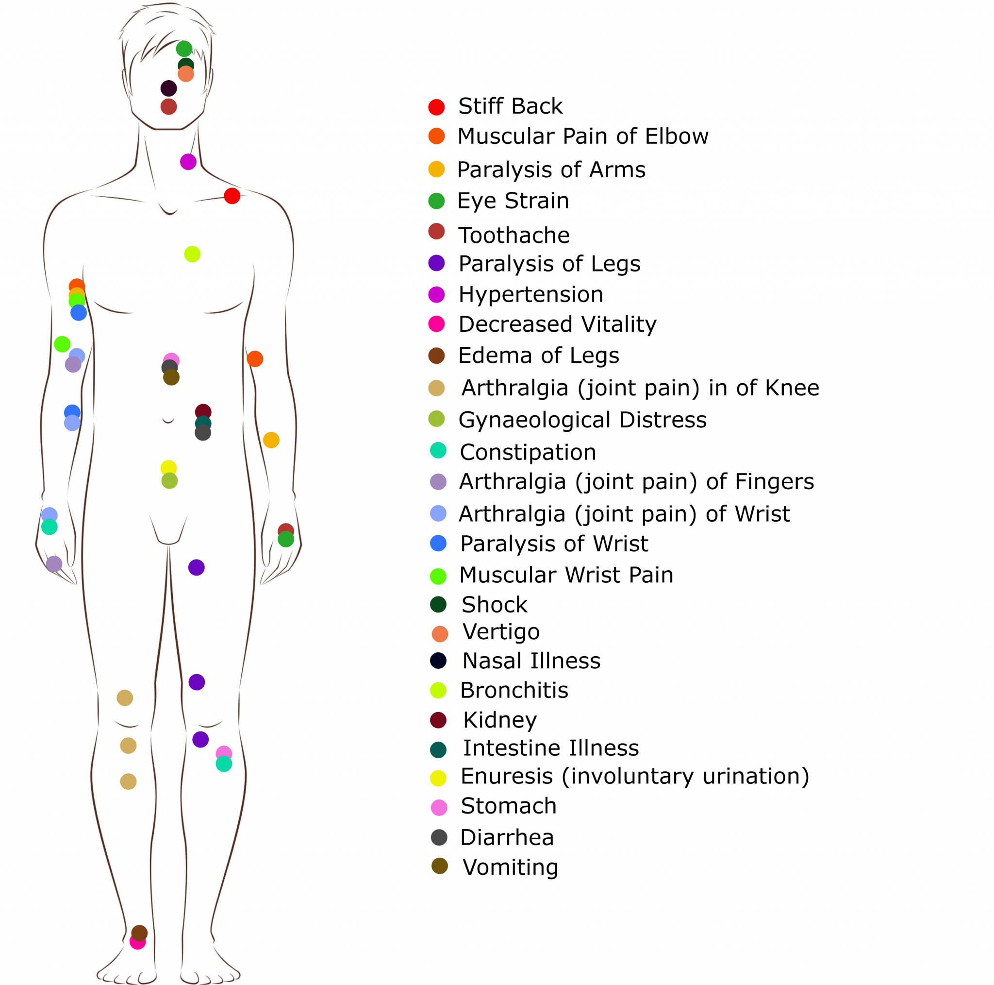 Foot reflexology chart to map sole zones and organs